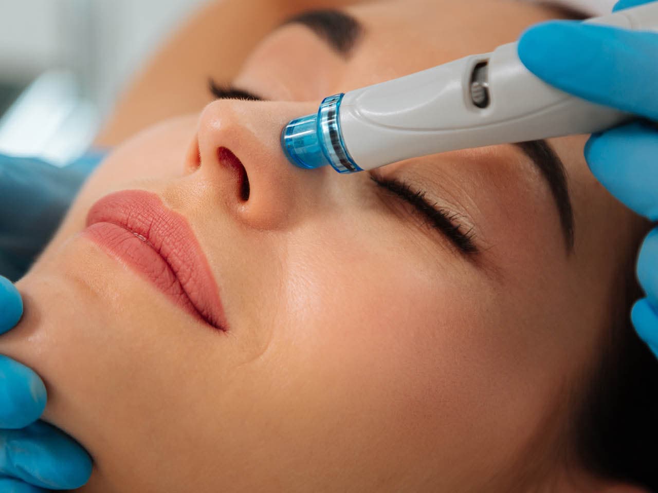 Hydra Facial